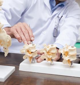 Doctor examining spine models with degenerative disc disease