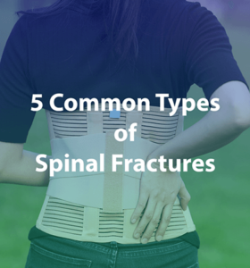 woman with spinal fracture wearing spine splint
