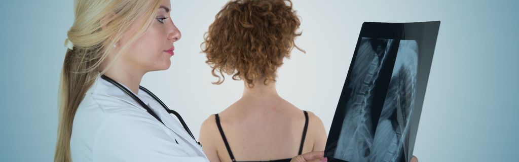 doctor examines x-ray of adolescent spine with spinal deformity