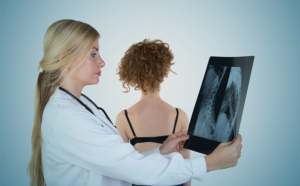 doctor examines x-ray of adolescent spine with spinal deformity