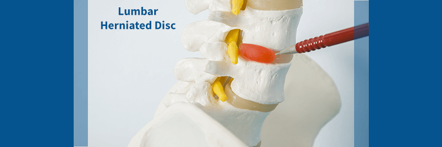 The Five Most Common Herniated Disc Symptoms