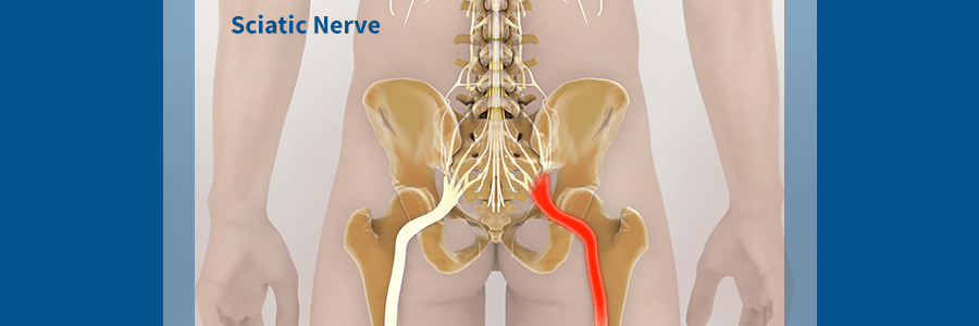 sciatica nerve