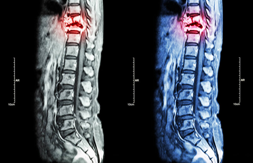 x-ray of back and spine